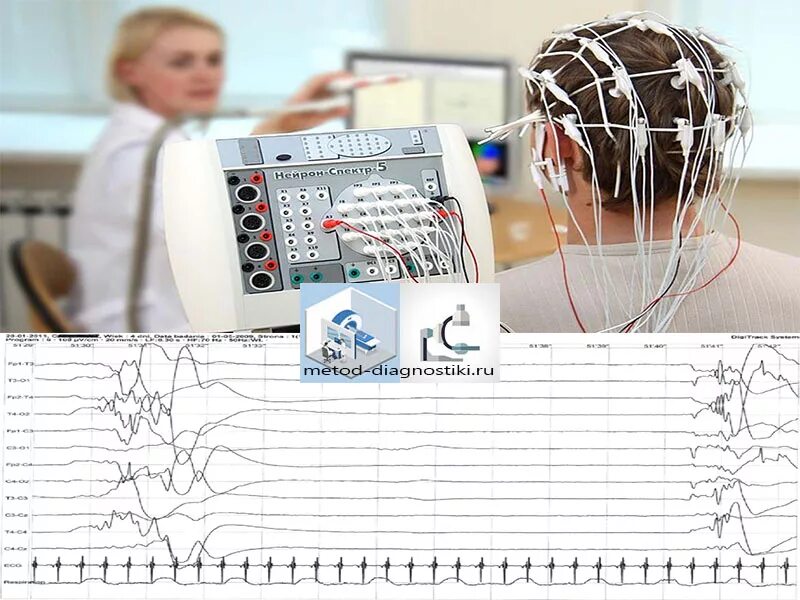 Ээг тольятти. Энцефалограмма. ЭЭГ. ЭЭГ прибор. Электроэнцефалография рисунок.