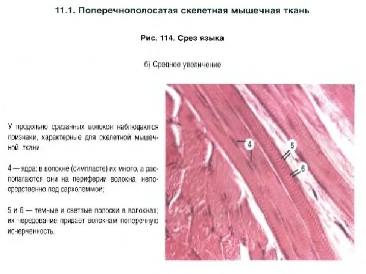 Мышцы языка тип ткани. Поперечная скелетная мышечная ткань препарат гистология. поперечнополосатая скелетная мышечная ткань языка препарат. поперечно полосатая скелетная ткань препарат. поперечно-полосатая скелетная мышечная ткань языка кролика.