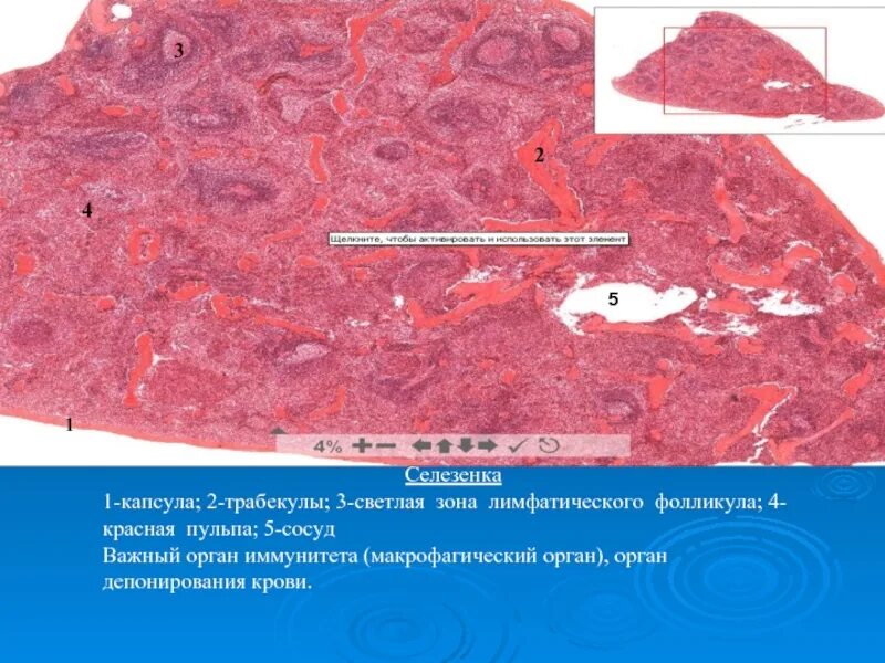 Лимфоидный фолликул селезенки гистология. Красная пульпа селезенки гистология. Белая пульпа селезенки гистология. Красная и белая пульпа селезенки. Стволовые клетки селезенки