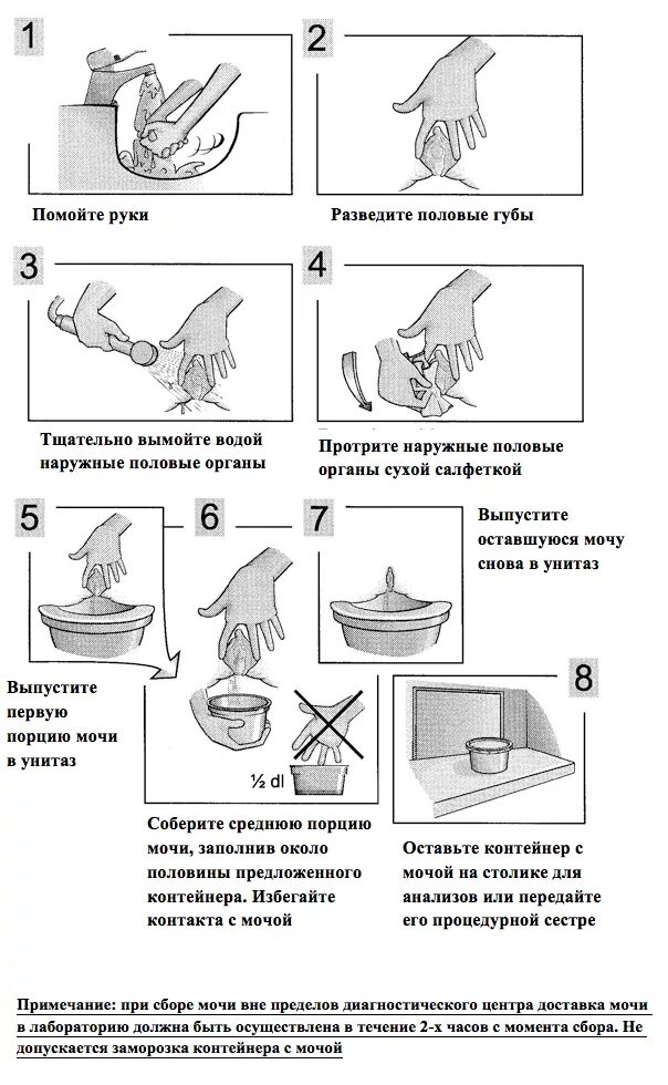 Как собрать анализ мочи утром. Как собрать мочу на общий анализ. Как собрать анализ мочи. Как сдавать общий анализ мочи женщинам. Как правильно сдавать общий анализ мочи.