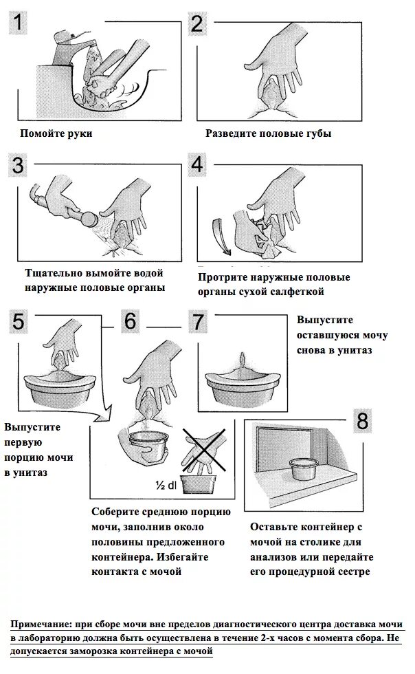 Как правильно собирать мочу беременным