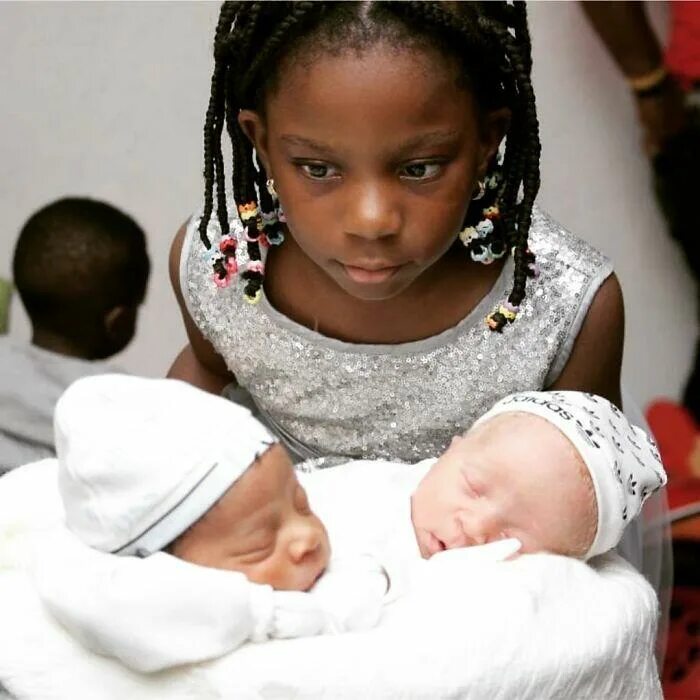 Близняшки с разным цветом кожи. С рождением тройняшек. Двойняшки. Близнецы с разным цветом кожи фото. Близнецы.