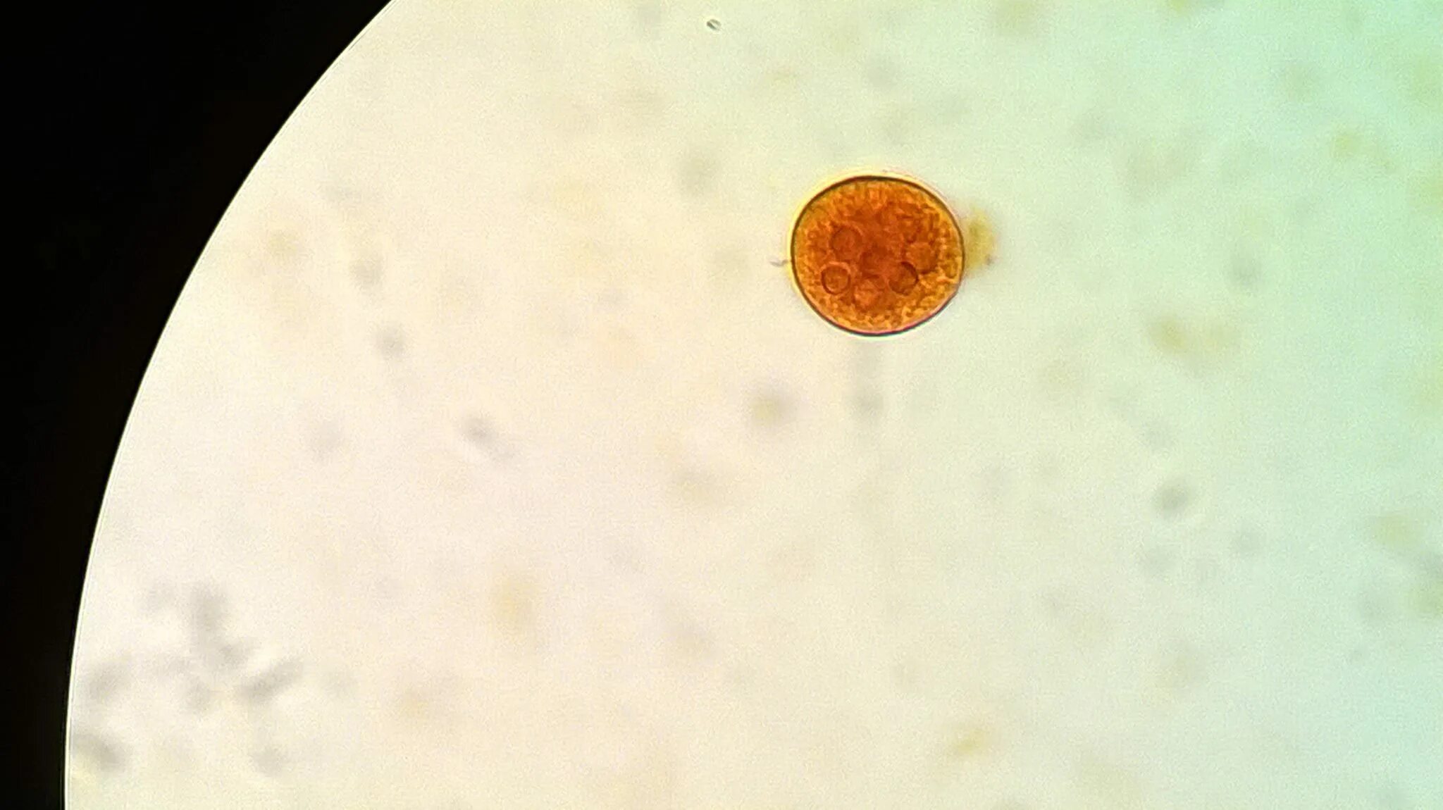 Цисты Entamoeba. Цисты лямблий под микроскопом. Entamoeba coli циста. Цисты кишечной амебы (Entamoeba coli). Entamoeba coli в кале