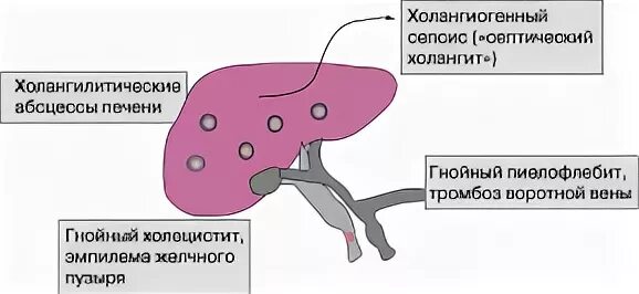 Холангит у кошек