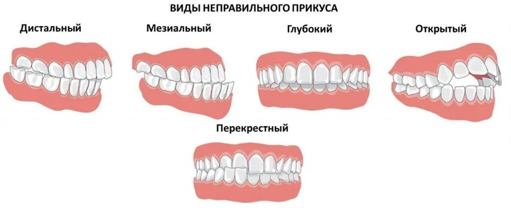 Какие должны быть зубы у человека