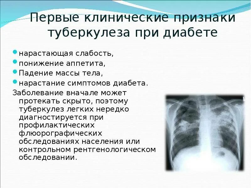 Какое время проявляется туберкулез. Туберкулёз симптомы у детей 5 лет. ранними симптомами туберкулеза являются. первичный туберкулез симптомы. симптомы туберкулеза органов дыхания.