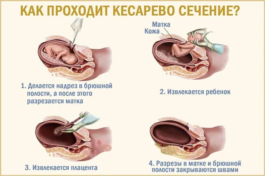 Через какое время после рождения можно