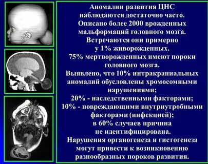 Врожденный порок нервной системы