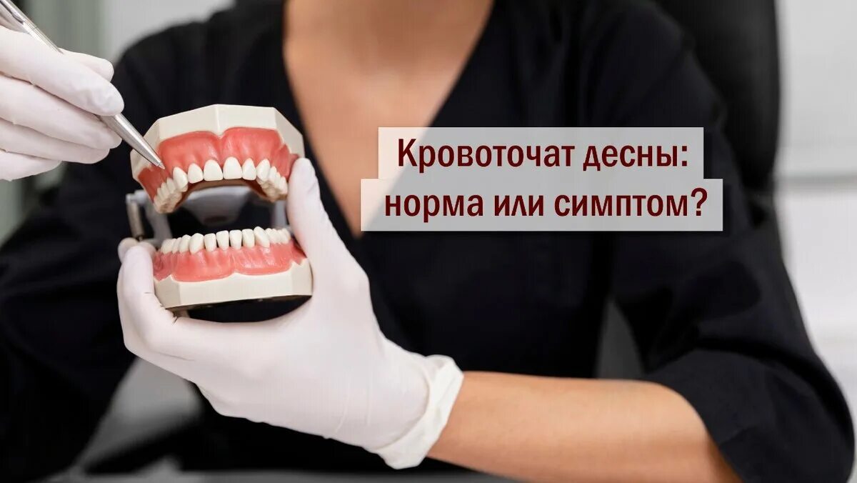 После профессиональной чистки зубов кровоточат Десна. Кровоточивость десен причины. Кровоточат Десна и запах изо рта причины.
