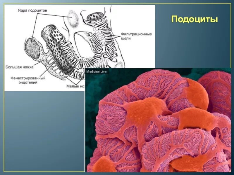 Строение подоцитов. Подоциты эпителиальные. Подоциты. Строение почки подоциты. Подоциты гистология.