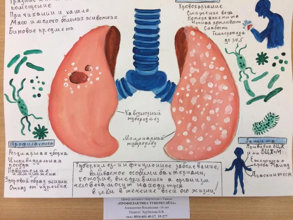 Роспотребнадзор туберкулез. Туберкулез плакат. Туберкулез рисунок. Плакат на тему туберкулез. Рисунок на тему туберкулез.