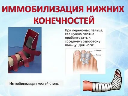 Перелом голеностопного сустава иммобилизация