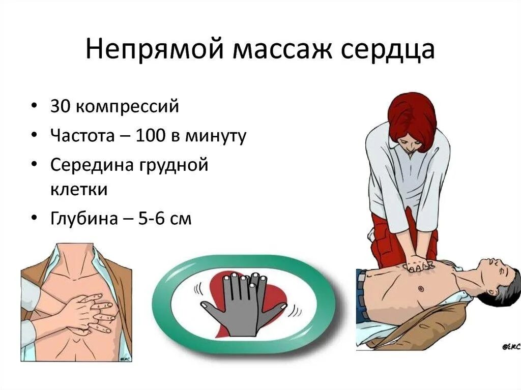 Как сделать непрямой массаж. Алгоритм проведения непрямого массажа сердца. непрямой массаж сердца техника выполнения 1. закрытый массаж сердца алгоритм техника проведения. +последовательность проведения закрытого непрямого массажа сердца.