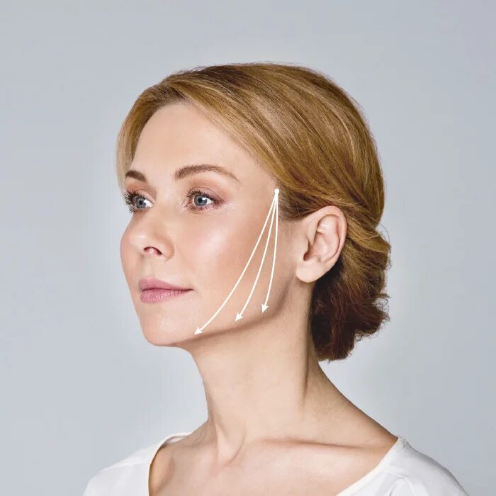 подтяжка подбородка. убрать подбородок нитями. нити аптос для подтяжки подбородка. армирование подбородка нитями. убрать подбородок нитями.