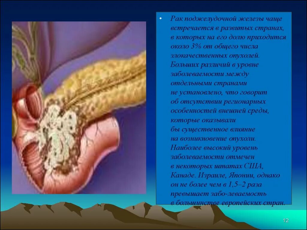 Как выглядит рак поджелудочной железы Pin on Sc/med news
