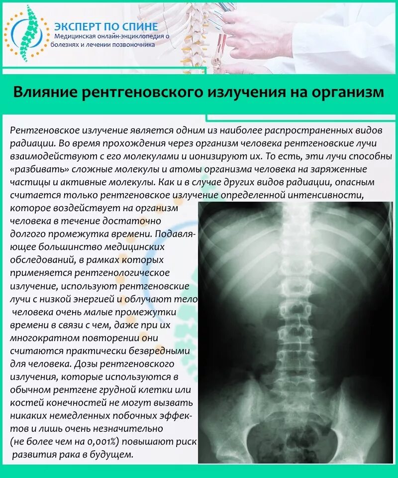 Сколько раз делать рентген. Рентгенография грудного отдела позвоночника (2 проекции). влияние рентгеновского излучения на организм человека. рентгеновское излучение влияние на организм. влияние излучения на организм рентген.