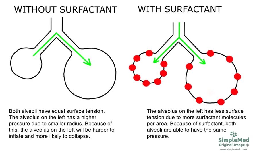 Art fact soft surfactant complex. Art fact soft surfactant complex