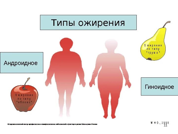 Схема ожирения. Типы ожирения гиноидное и андроидное. гиноидный тип ожирения у женщин. ожирение по андроидному типу. типы ожирения в зависимости от распределения жировой ткани.