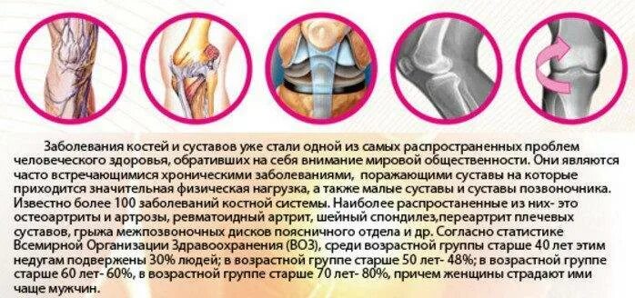 Трение при движении костей в суставе