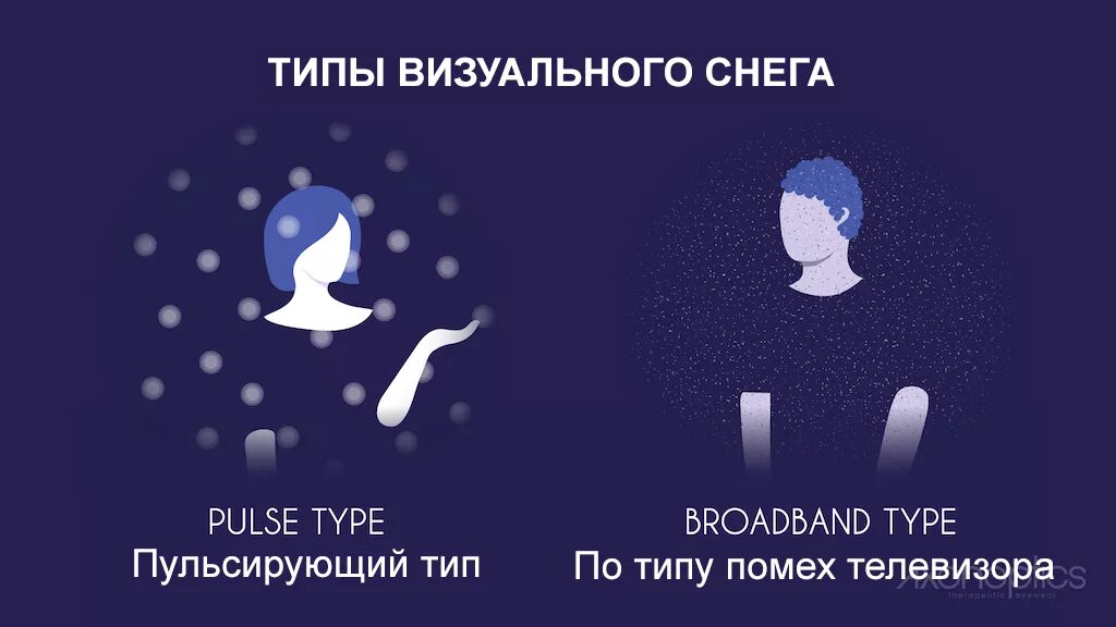 Синдром визуального снега. Эффект визуального снега. визуальный снег в глазах. визуальный снег в темноте.