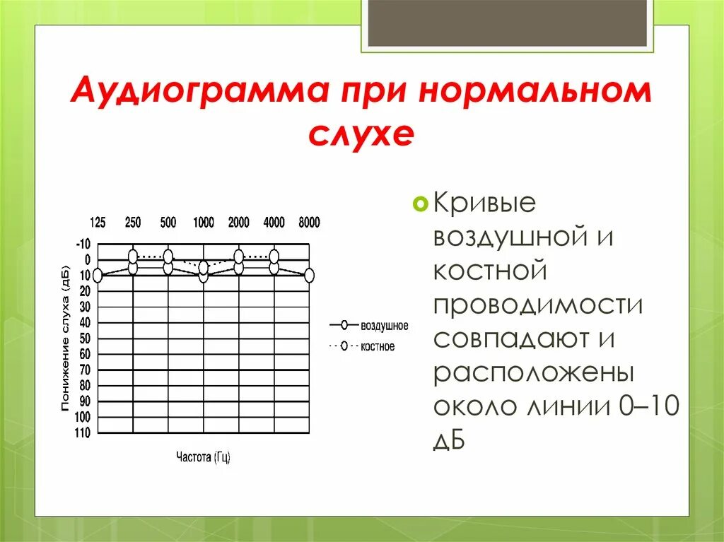 Расшифровка аудиограммы