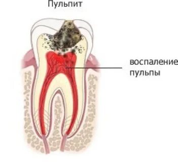Пульпа вино
