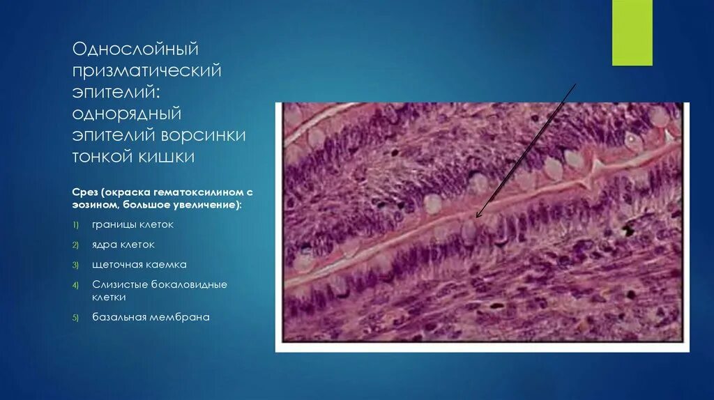 Гистология экология. Однослойный призматический эпителий гистология. однослойный призматический ворсинчатый эпителий тонкой кишки. однослойный однорядный каемчатый эпителий. тонкая кишка гистология препарат.