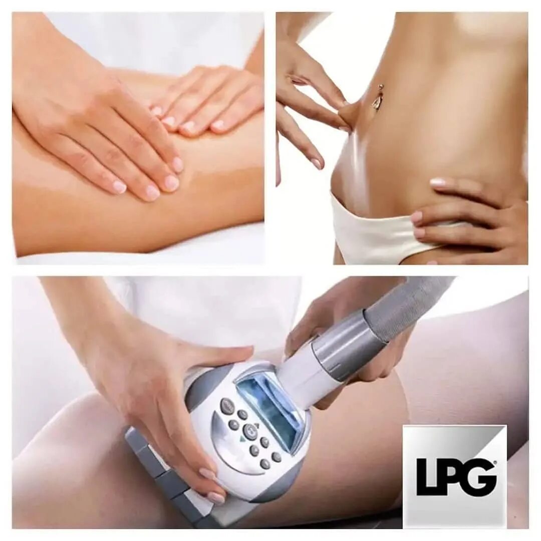 Lpg массаж эффективность. Lpg массаж плюс миостимуляция. Lpg массаж частота процедур. Alma lasers accent. Lpg массаж эффективность.