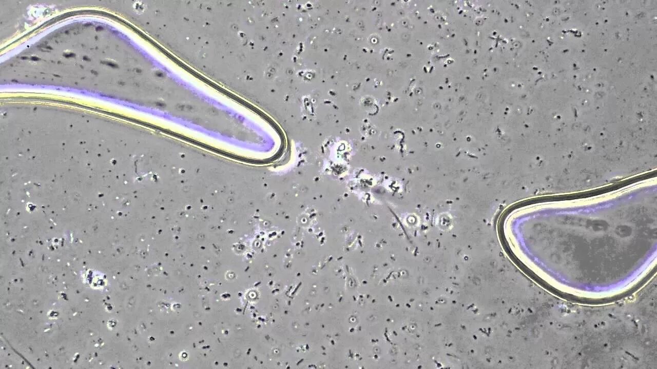 Бактерии Beijerinckia Fluminensis. Йогуртовые бактерии в микроскоп. Бактерии в слюне под микроскопом. Живые бактерии под микроскопом. Бактерии в слюне