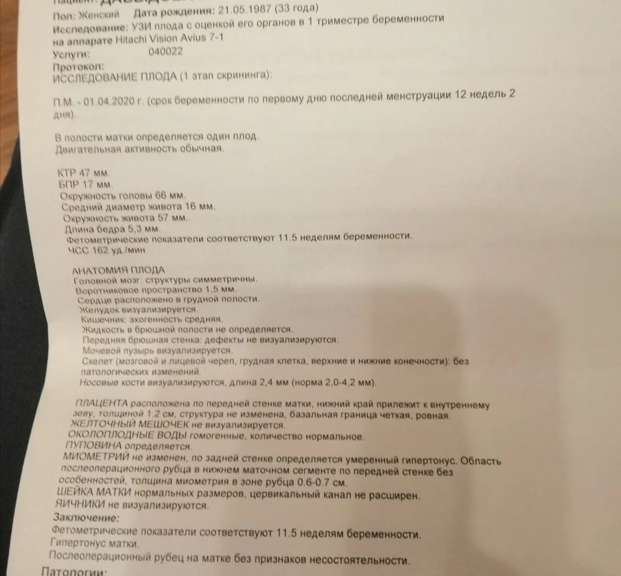 Что показывает первый скрининг в 12 недель. Второй скрининг при беременности 20 недель узи. узи на 12 неделе беременности скрининг. заключение узи при беременности 12 недель. узи скрининг 1 12 недель беременности.