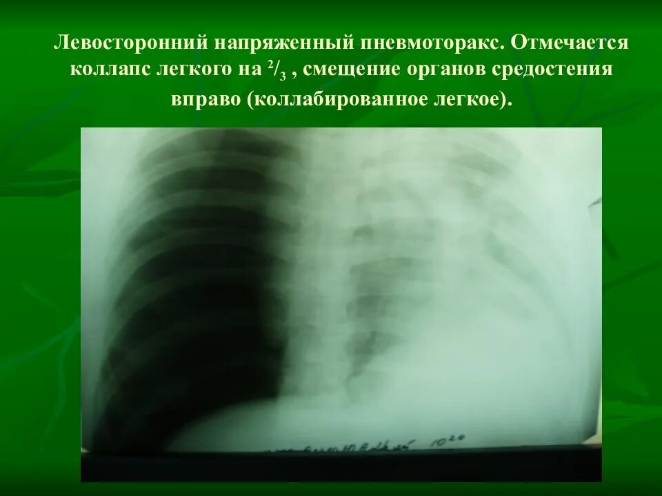 Коллабирование это