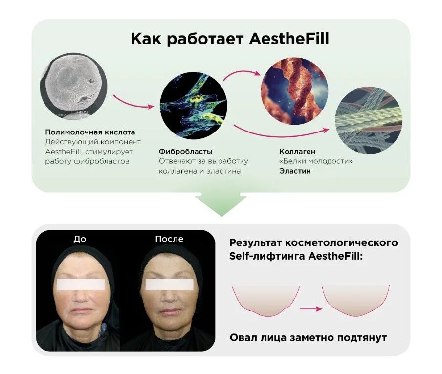 AESTHEFILL препарат. AESTHEFILL (Эстефил). Филлер AESTHEFILL. Эстерфилл полимолочная.