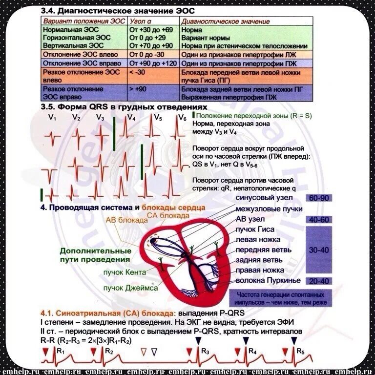 Шпаргалка по ЭКГ. ЭКГ расшифровка шпаргалка. Шпаргалка по ЭКГ для скорой помощи. Шпоры по ЭКГ. Сердце против часовой стрелки