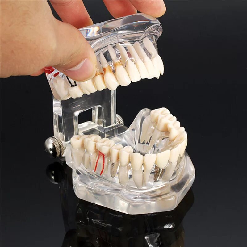 Искусственные зубы. Искусственная челюсть. Пластмассовые искусственные зубы. Модель зубов.