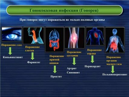 Инфекция мужских половых органов