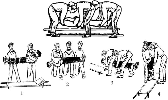 Перелом голени транспортировка. Укладывание на носилки. Транспортировка на носилках. Способы выноса пострадавших из очага поражения. Транспортировка пострадавшего.