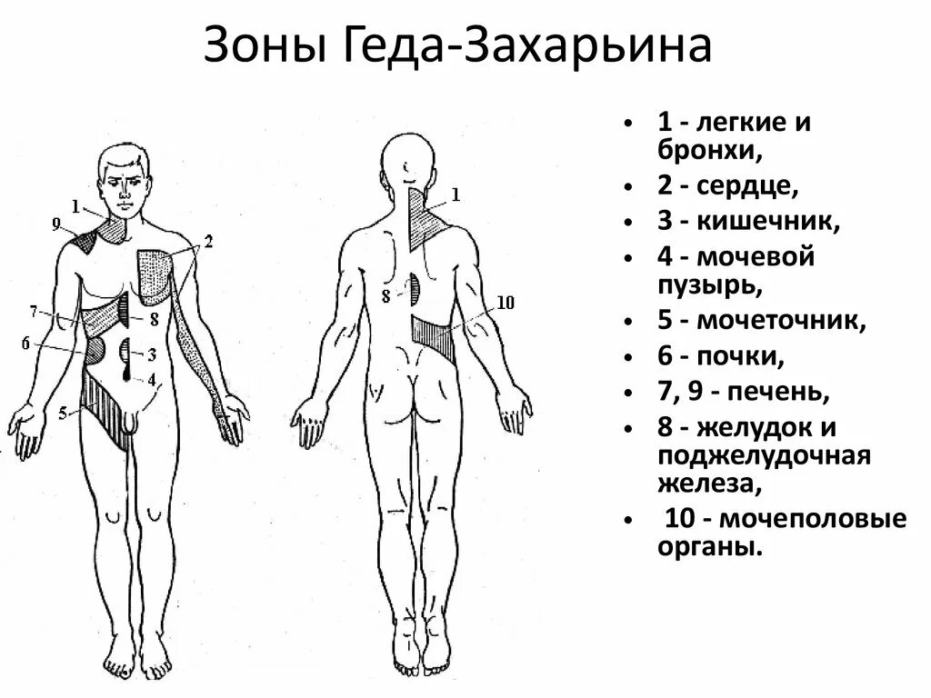 Схема боли в спине. Проекционные зоны Захарьина-Геда схема. Зоны Захарьина-Геда схема и описание. Зоны Захарьина Геда на спине. Зоны кожной гиперестезии Захарьина Геда.