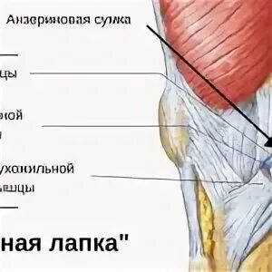 Лечение гусиной лапки. Бурсит сухожилия гусиной лапки коленного сустава. сухожилие гусиной лапки коленного сустава. бурсит гусиной лапки анзериновый бурсит. бурсит гусиной лапки коленного сустава анатомия.