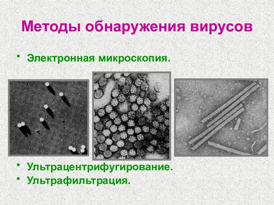 Как обнаружить вирус. Микроскопия вирусов. методы обнаружения вирусов. электронная микроскопия вирусов. метод электронной микроскопии.