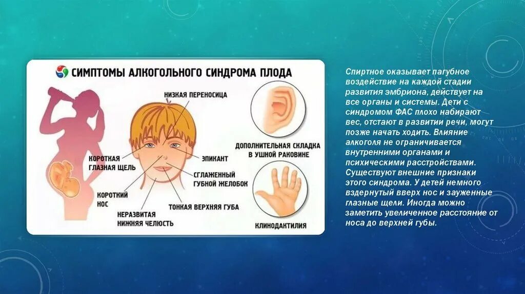 Признаки фетального алкогольного. Симптомы алкогольного синдрома плода. Фетальный алкогольный синдром. Фетальный алкогольный синдром признаки.