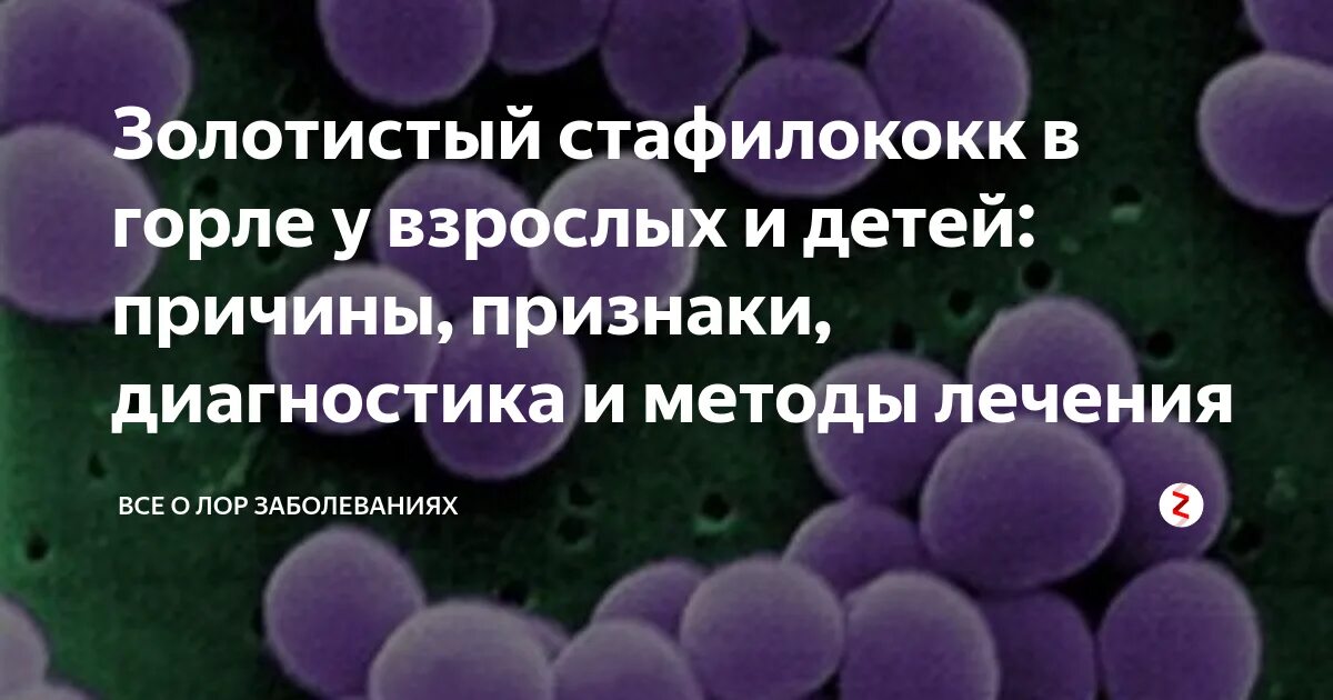 Staphylococcus aureus в носу. Стафилококковая инфекция в горле. Стафилококковая инфекция в носоглотке. Золотистый стафилококк в го. Золотистый стафилококк в горле.