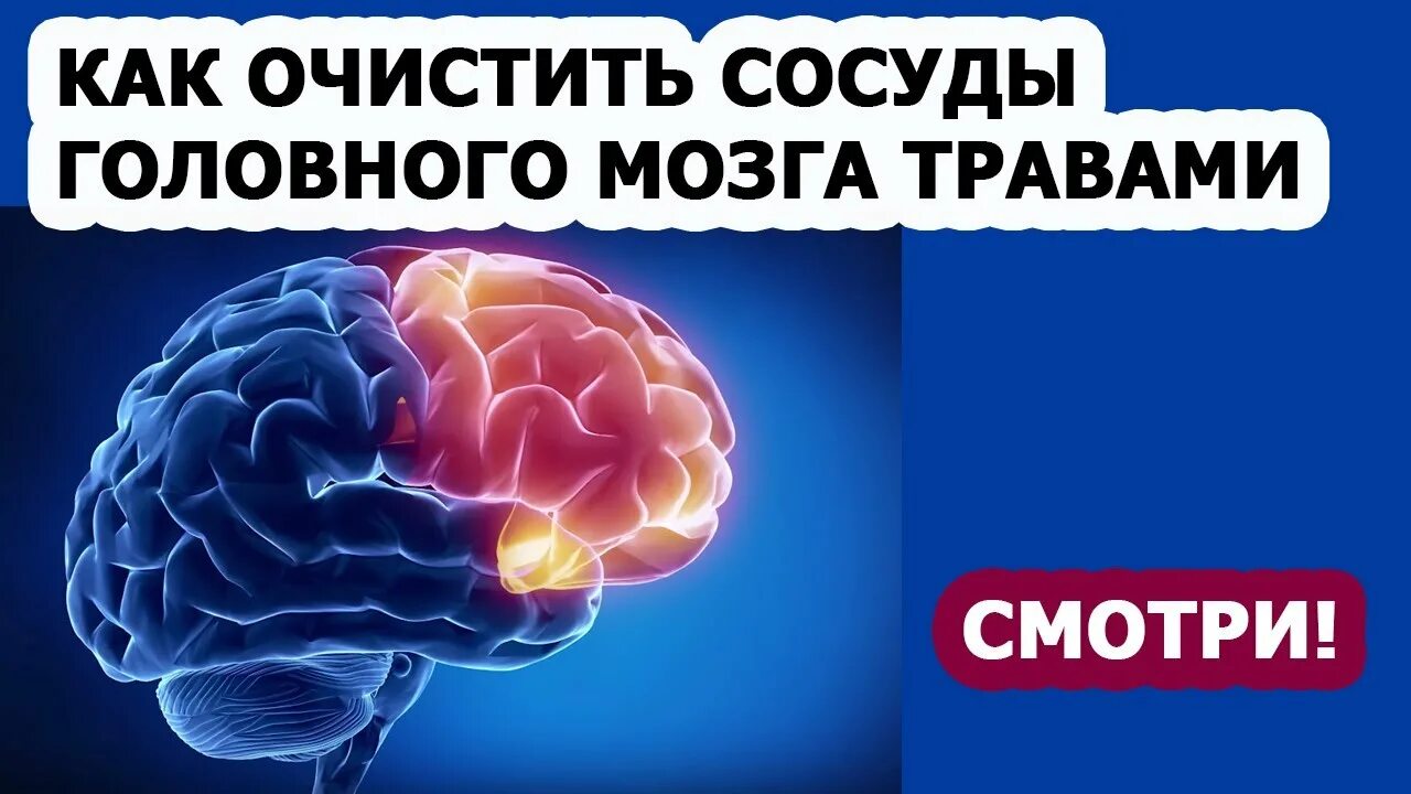 Очистка сосудов головы. Очистка сосудов головного мозга. Для профилактики сосудов головного мозга. Как чистить сосуды головного мозга. Для очистки сосудов головы.