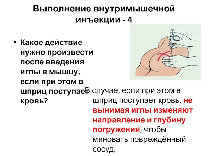 Как правильно делать укол внутримышечно. Схема внутримышечной инъекции. Куда ставить укол. Как ставить укол внутримышечно в ягодицу. Схема уколов внутримышечно в ягодицу.