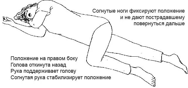 Правила оказания первой помощи при сотрясении мозга. Положение тела при сотрясении головного мозга. Положение больного при сотрясении головного мозга. Положение пострадавшего. Положение пострадавшего на боку.