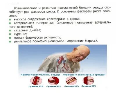 Инсульт сердечные заболевания