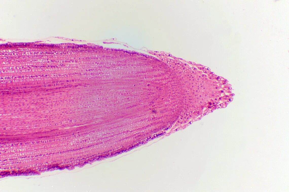 Корневой кончик. Корневой чехлик под микроскопом. Корневой чехлик микропрепарат. Микропрепарат кончика корня.