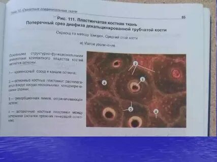 Поперечный срез костной ткани