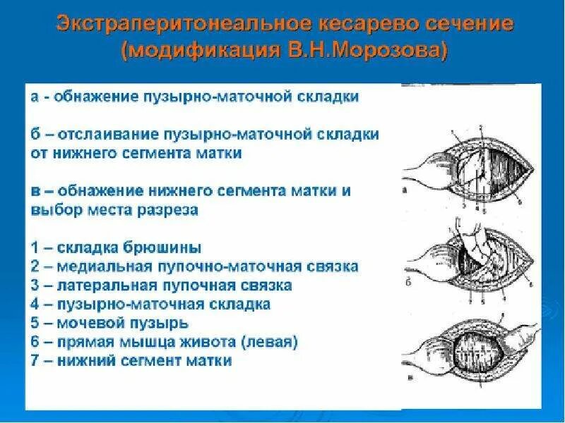 Кесеровое сечение. Экстраперитонеальное кесарево сечение. Пузырно маточная складка. Экстраперитонеальное кесарево сече. Поперечный разрез Нижнего сегмента матки.