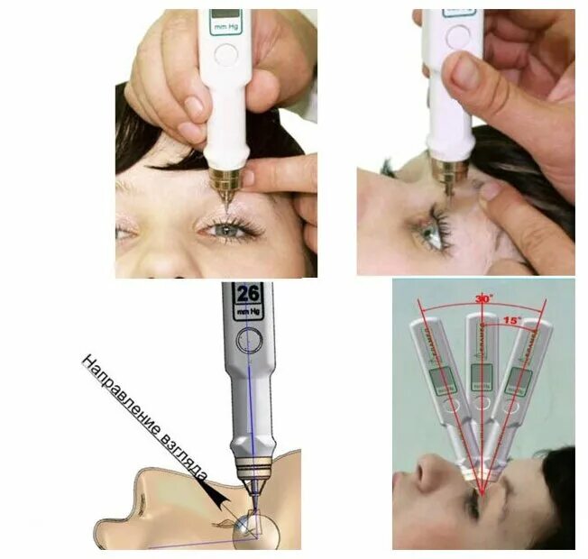 Тонометр внутриглазного давления твгд-02. Тонометр внутриглазного давления твгд-02, россия. Тонометр внутриглазного давления твгд-01, твгд-02. Твгд-02. Тонометр внутриглазного давления твгд-02.