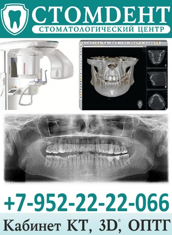 Где сделать кт зуба. Кт челюсти аппарат. Компьютерная томография зубов. Компьютерная томография зубов (кт).